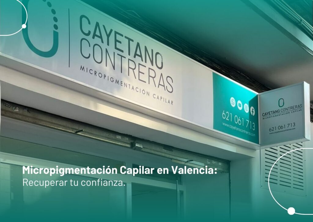 Micropigmentacion Capilar en Valencia Recuperar tu Confianza - Cayetano Contreras-min