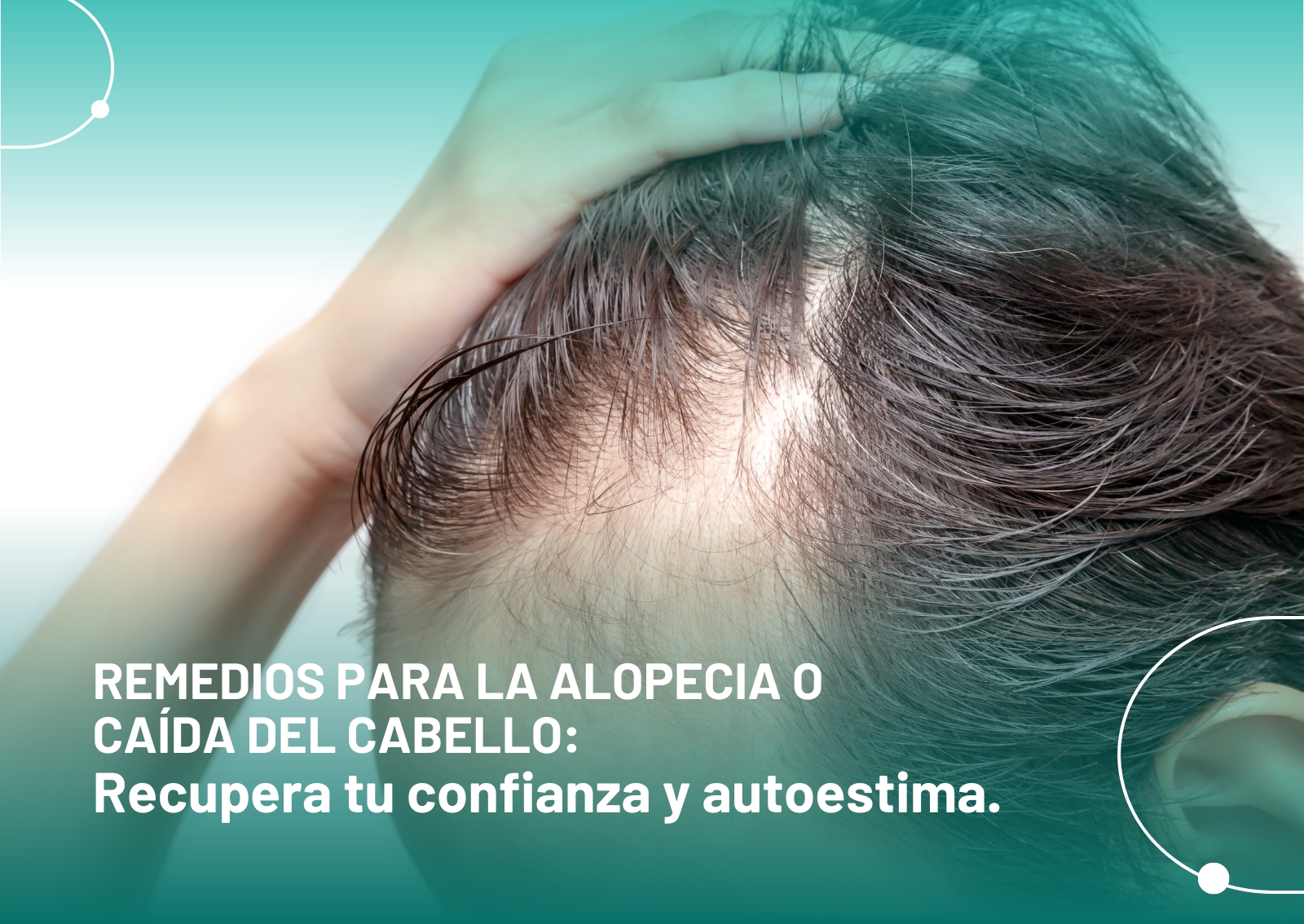 Remedios para la alopecia o caída del cabello